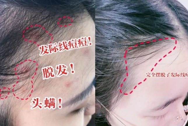 洗头干发神器！养出女明星绸缎发！冰球突破国产变态“抽水帽”入冬(图19)